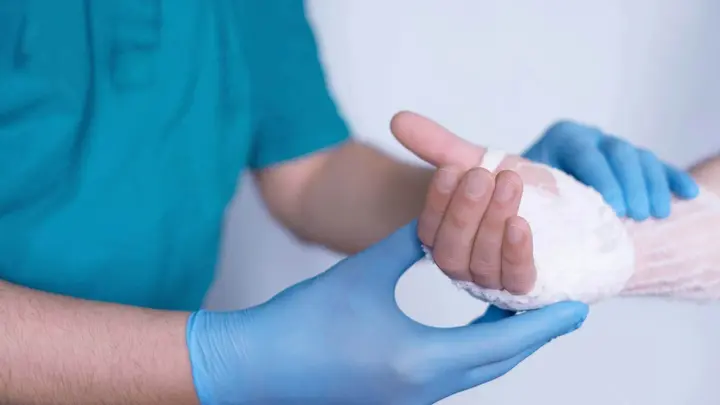 Ein Mitarbeiter der plastischen Chirurgie verbindet eine Verbrennungswunde an der Hand des Patienten.