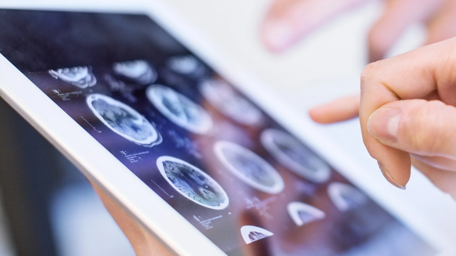 Röntgenaufnahmen auf einem Display