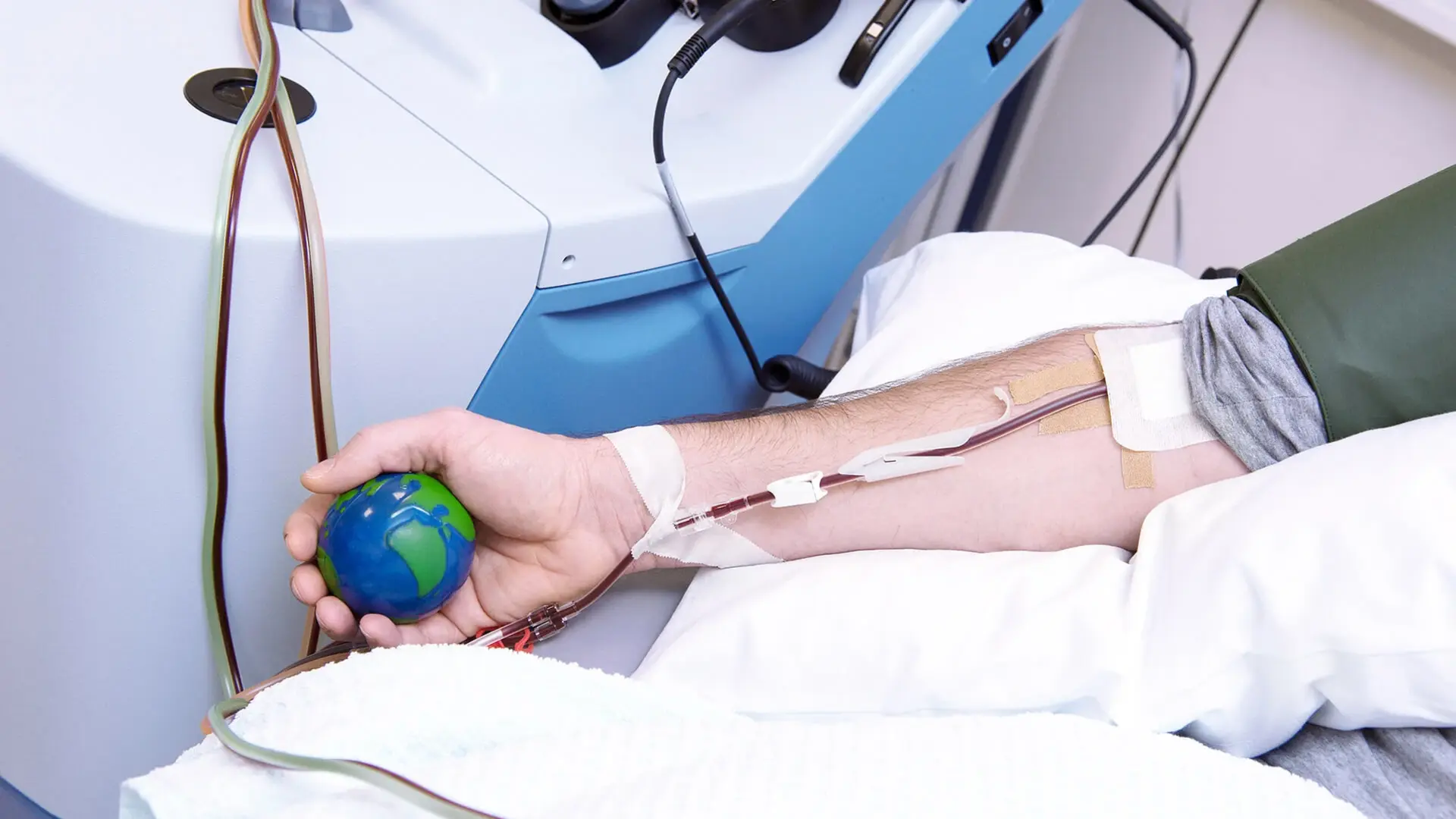 Ein Arm während einer Blutstammzelltransplantation.