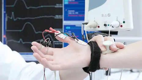 Hand während einer Elektromyographie.