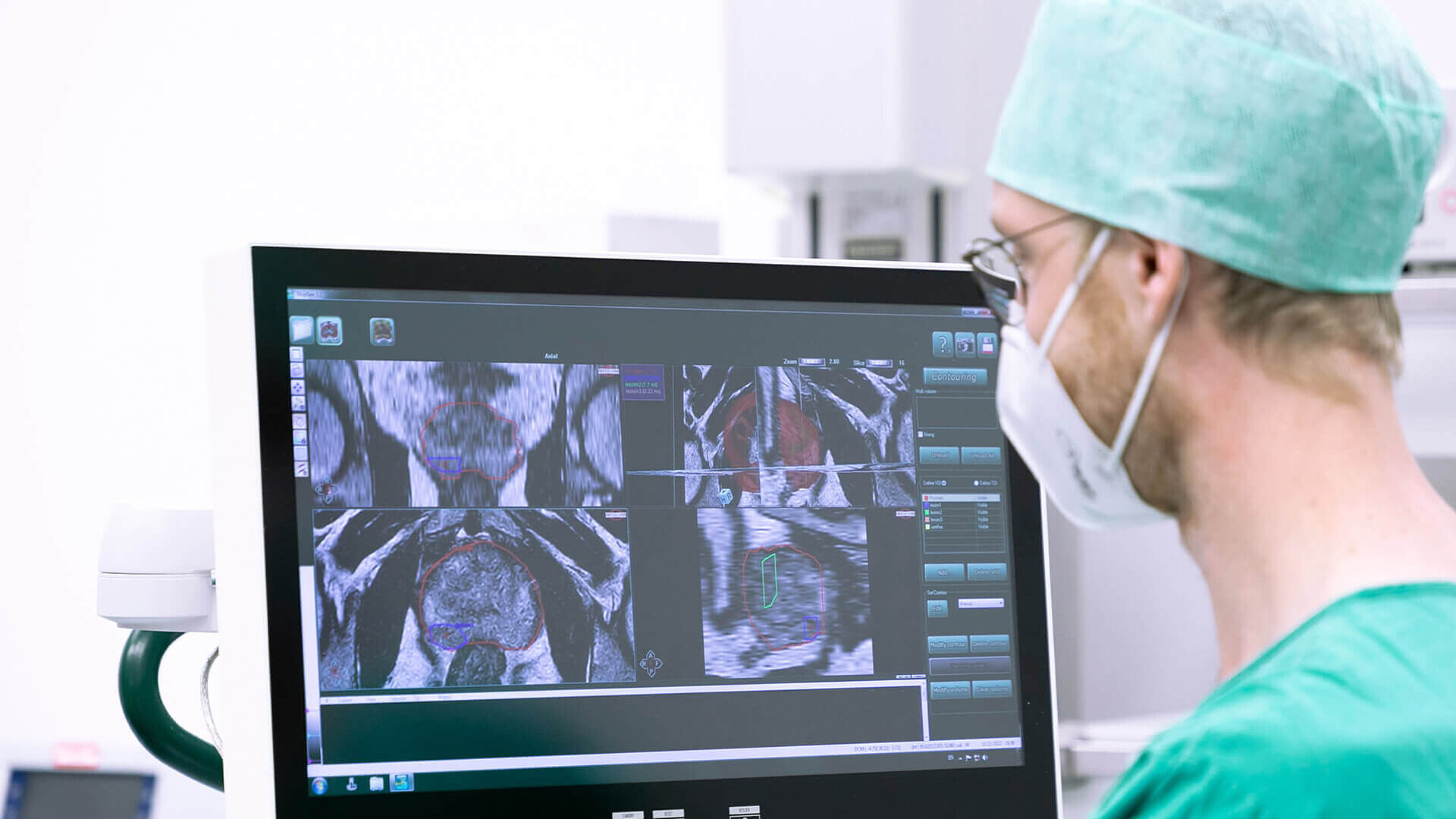 Urologische Tumoren - Klinikum Nürnberg | NÜRNBERG