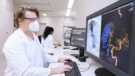 Ein Arzt der Neuroradiologie betrachtet Aufnahmen von Malformationen am Monitor.