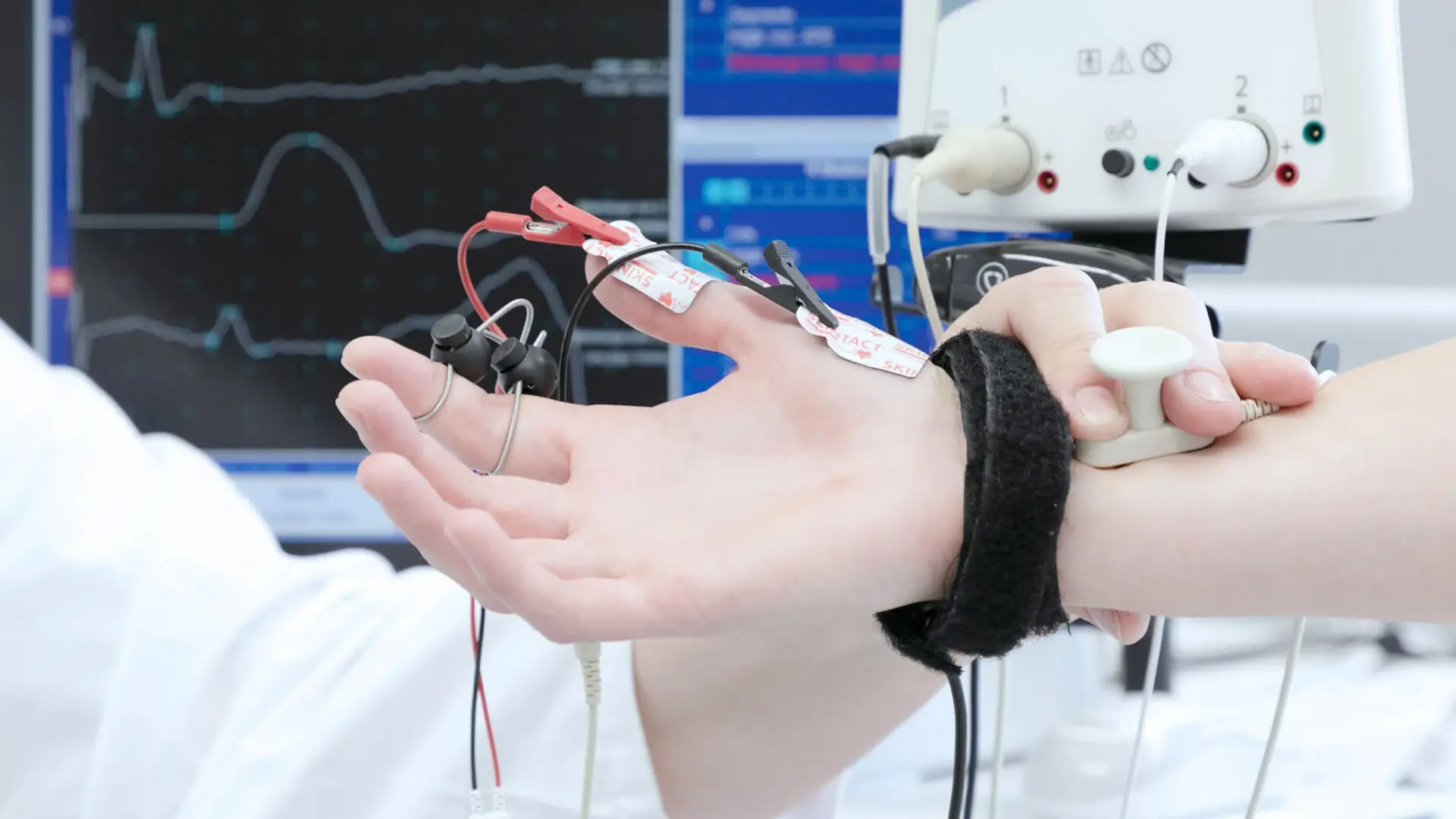 Hand während einer Elektromyographie.