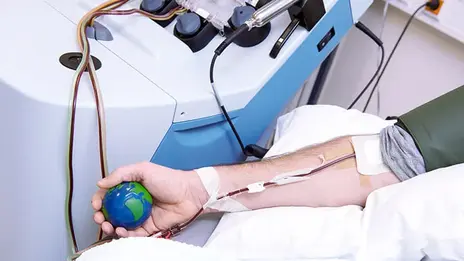 Ein Arm während einer Blutstammzelltransplantation.